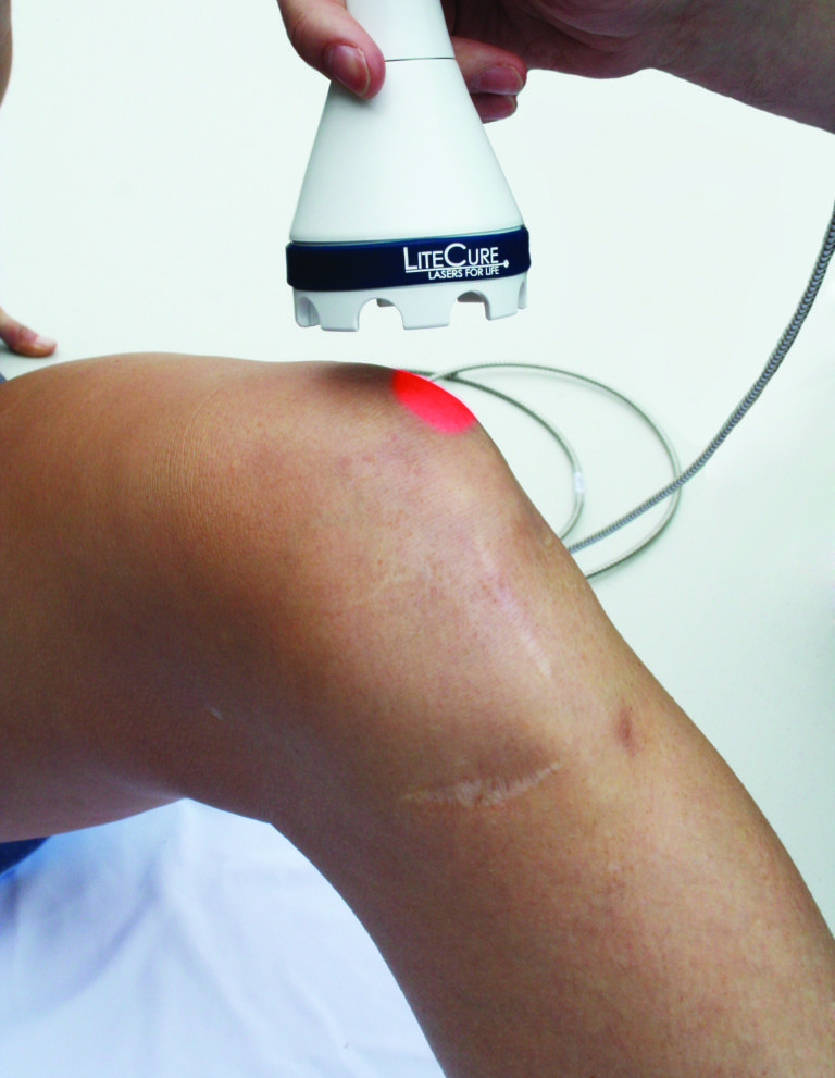 Laser Therapy  Center For Neck and Back Pain